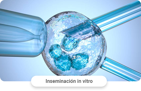 Procedimiento de FIV
