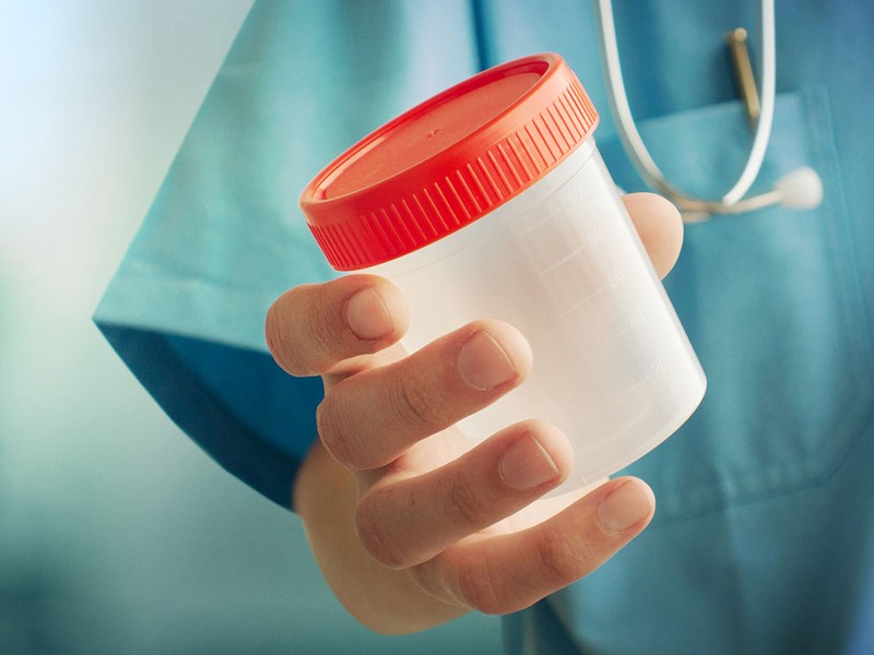 Processo de doação de esperma. FIV com esperma doado