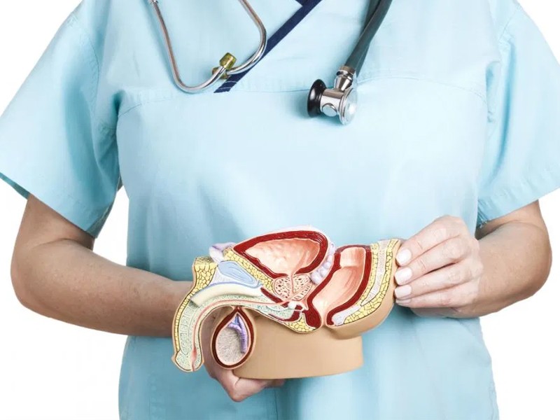 Varicocele
